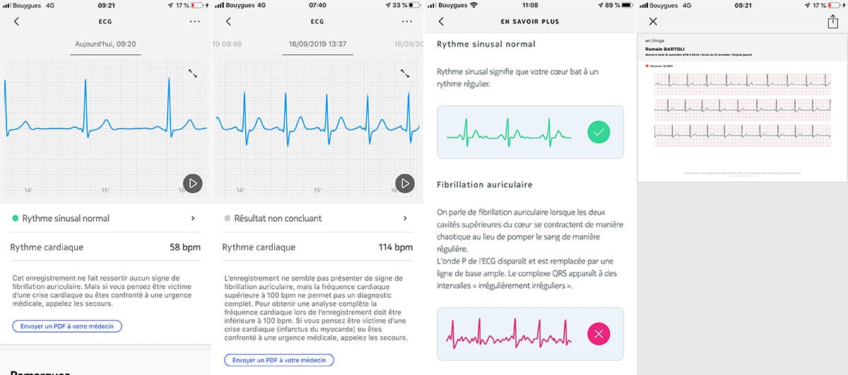 Test de la Withings Move ECG, la montre qui détecte les arythmies