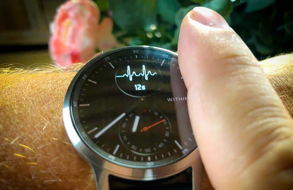 Enregistrement d'un ECG avec la Withings ScanWatch