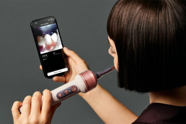 L'application Dyson CameraJet affichant le scan des dents en direct