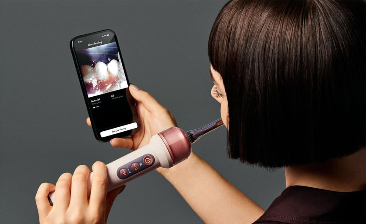 L'application Dyson CameraJet affichant le scan des dents en direct